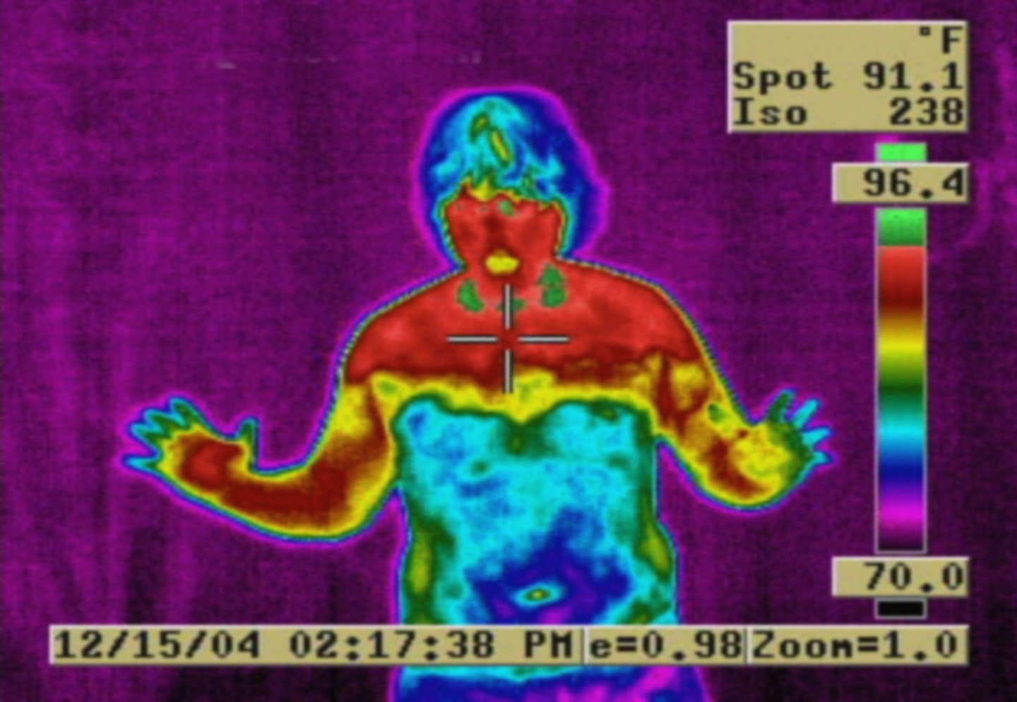 ets-surgery-thermal-wikimedia-commons